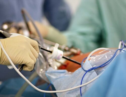 Лапароскопія в гінекології: що необхідно знати